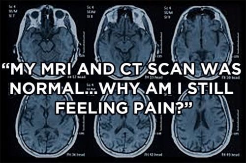 My MRI and CT scan was normal…why am I still feeling pain