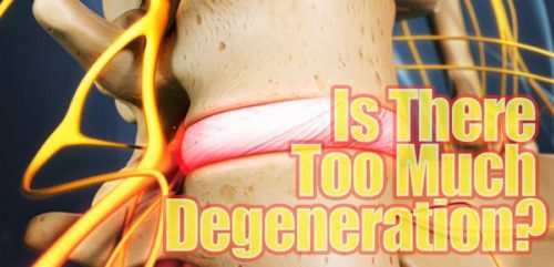 Is There Too Much Degeneration?