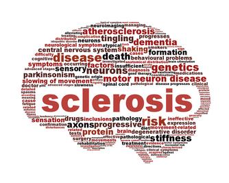 Promising Results for Multiple Sclerosis (MS) Patients