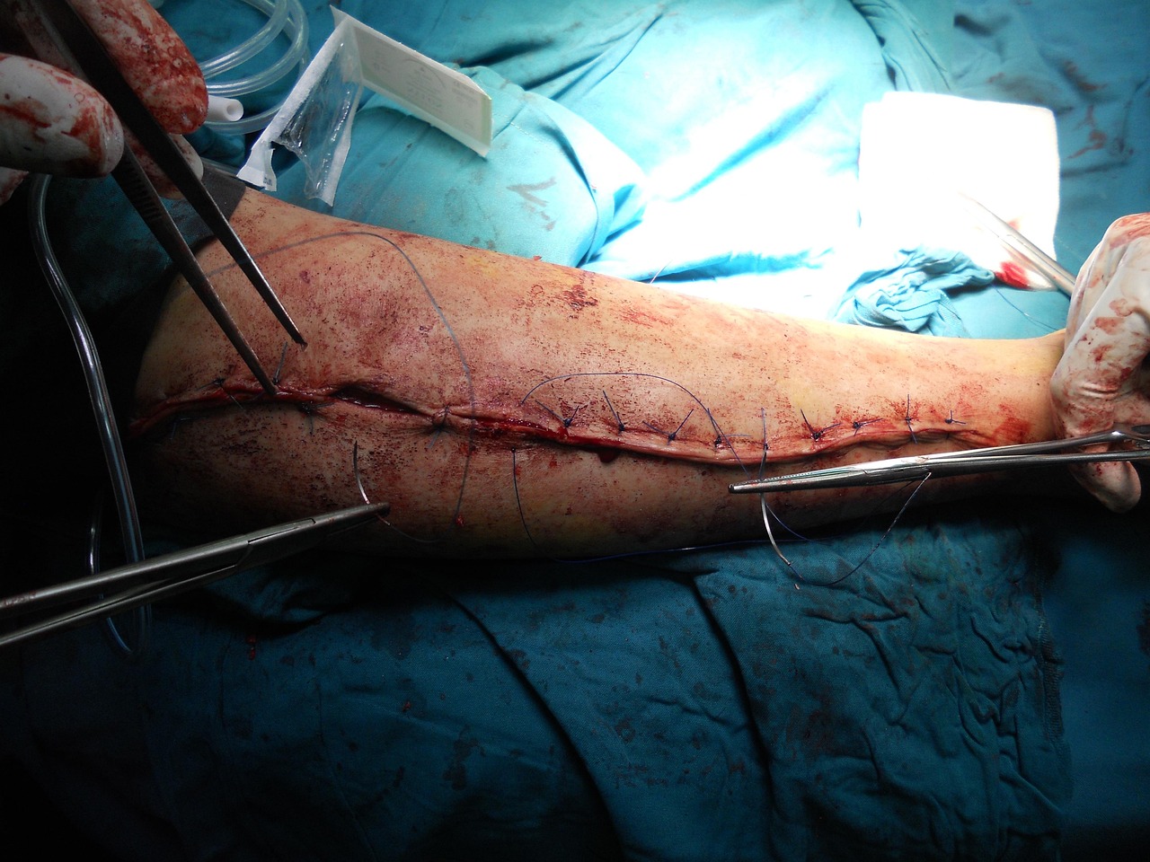 Tempe, AZ — Orthopedic Services for Back Pain and Core Stability Improvement