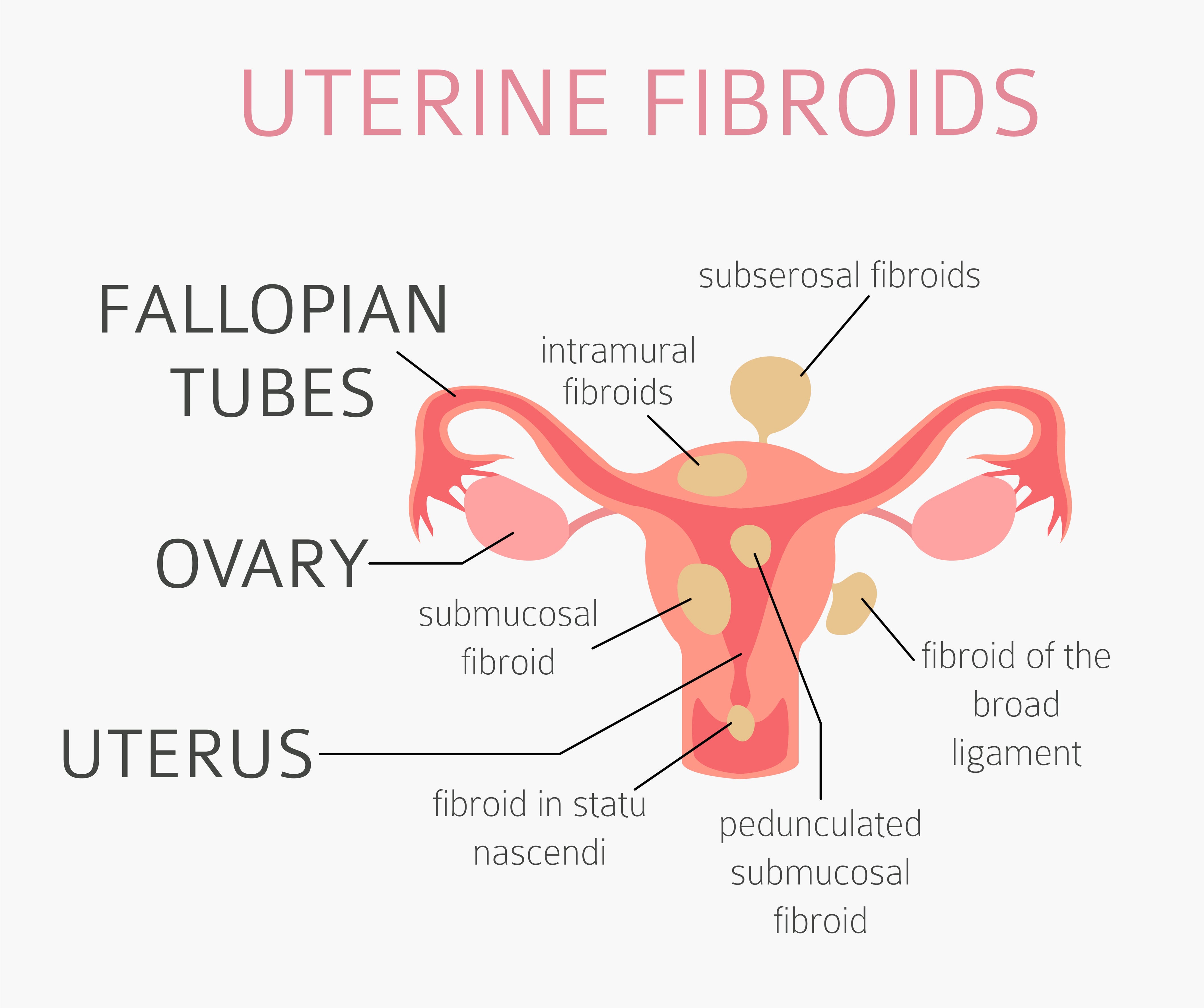 Atlanta, GA | Acupuncture for Women's Health | Essential Oils | Fibroids