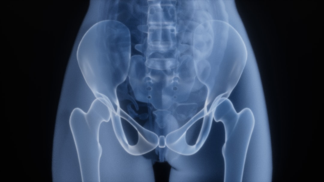 Tempe, AZ - Can Orthopedic Services Help with Arthritis Stiffness in Hips?