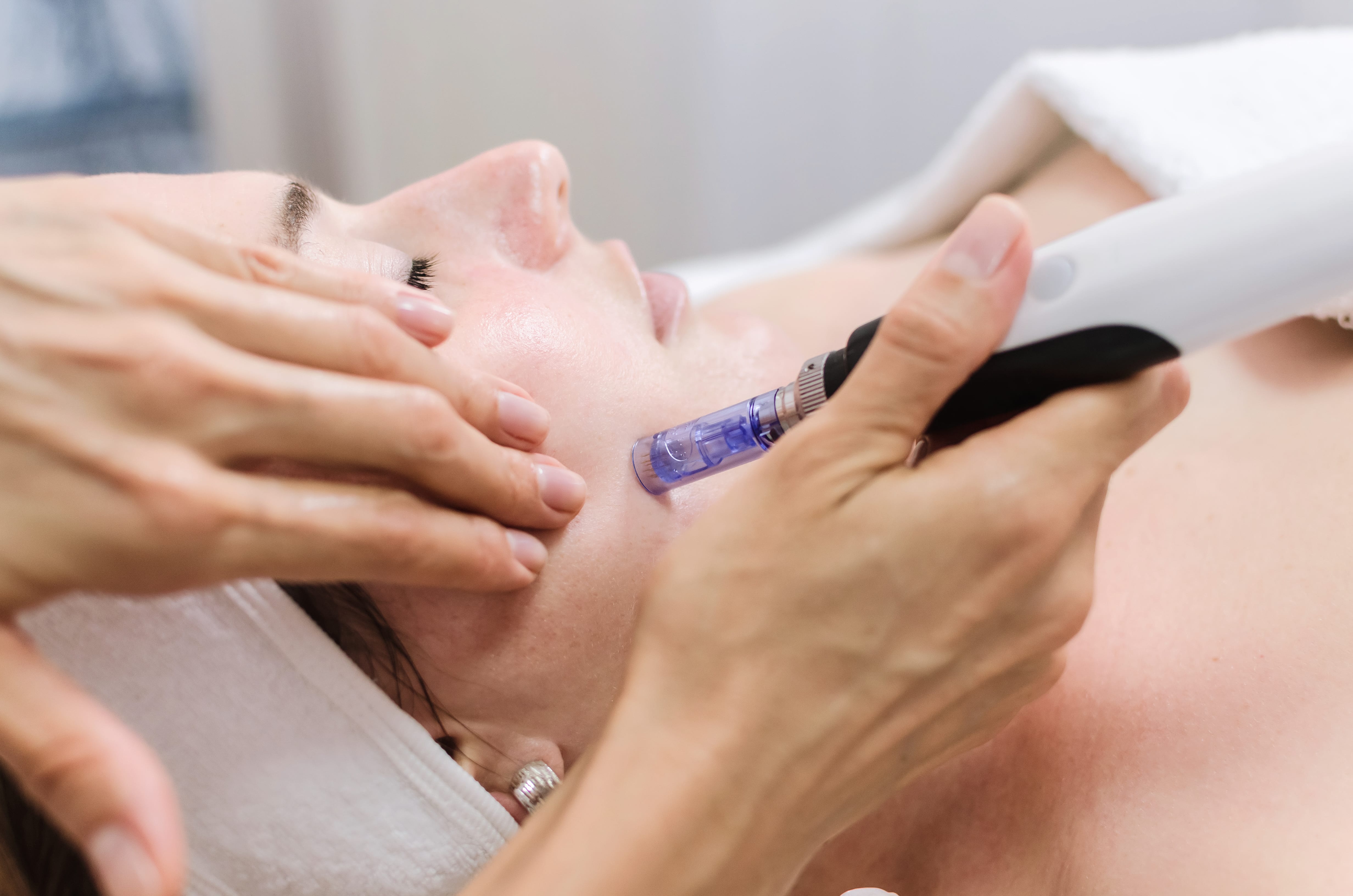 Fayetteville, GA | Top Beauty Consultant Offers Microneedling | Dysport, Botox
