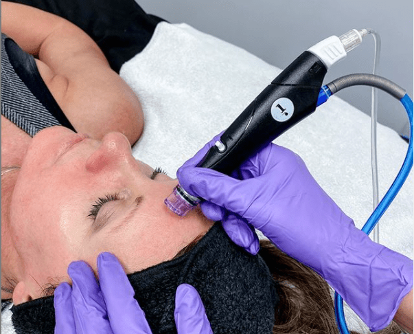 Fayetteville, GA - VIDEO | Skin Care Review-Hydrafacial | Skincare News