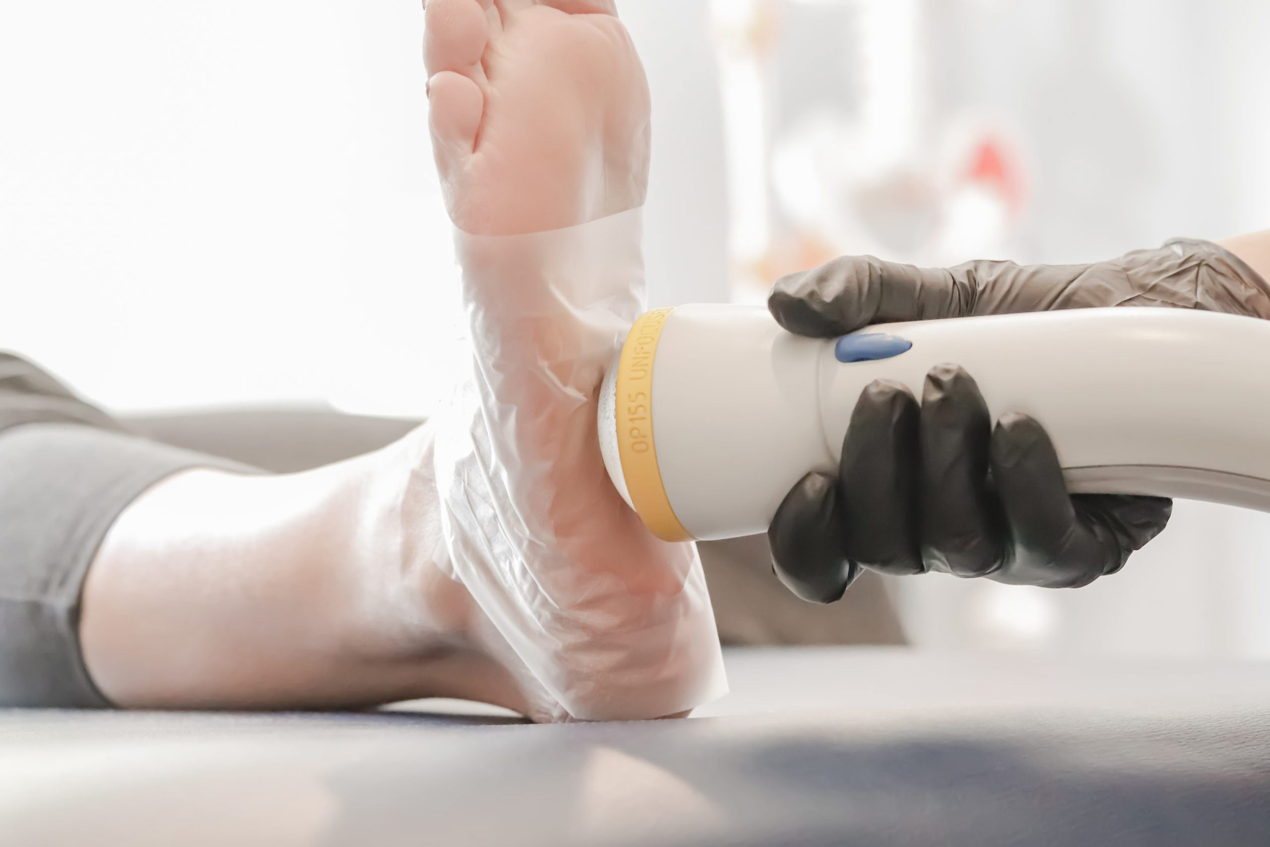 How SoftWave Therapy Can Treat Plantar Fasciitis