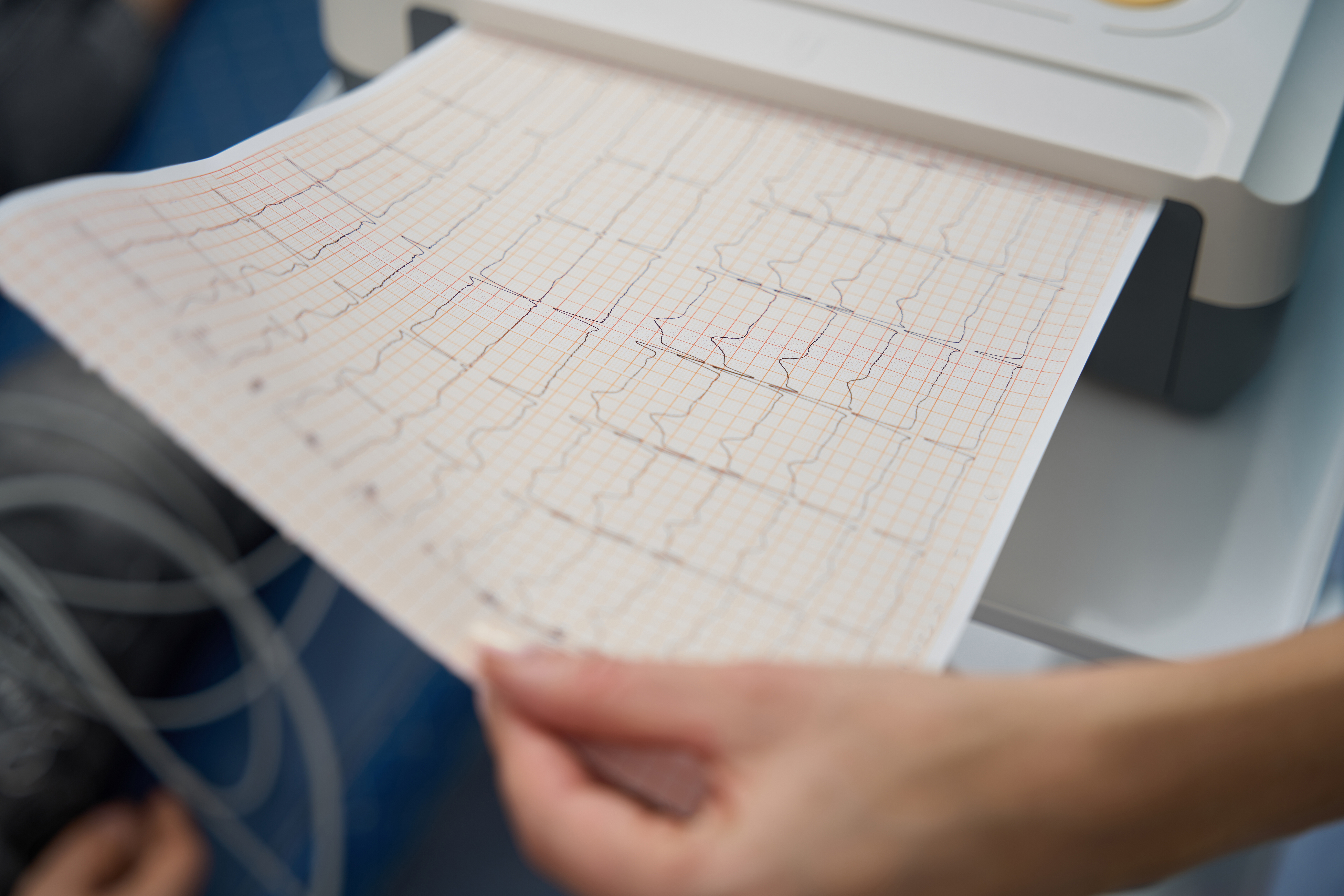 Afib May Be Caused By Your Neck