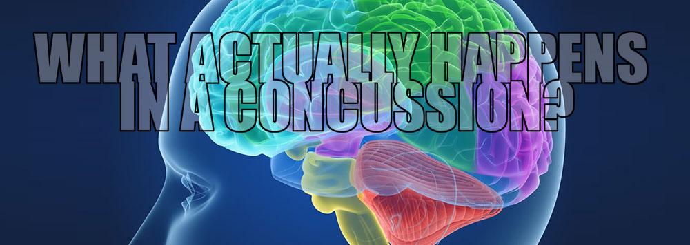 What actually happens in a concussion?