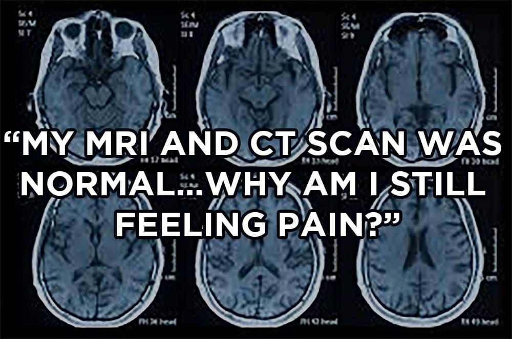 My MRI and CT scan was normal…why am I still feeling pain