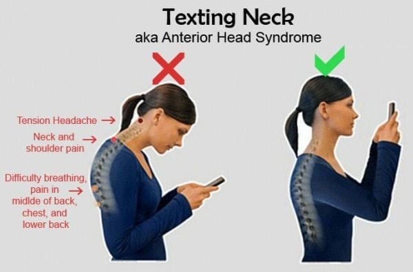 Text Neck: More serious than just a pain in the neck