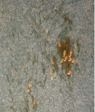 Controlling Mold Mites 