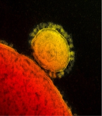 Virus