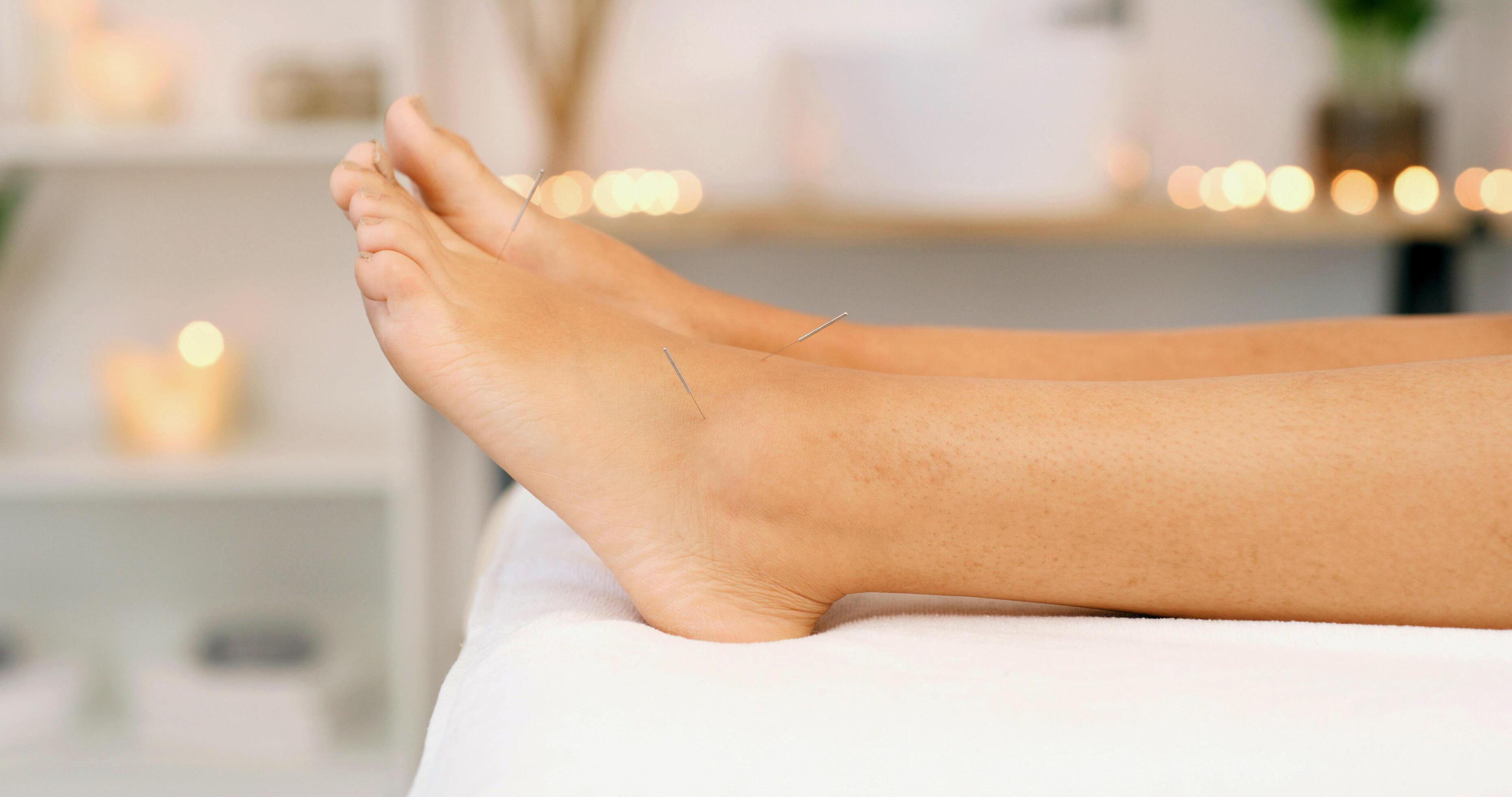 Goodyear, AZ — Dry Needling Treatment for Chronic Tendonitis and Pain