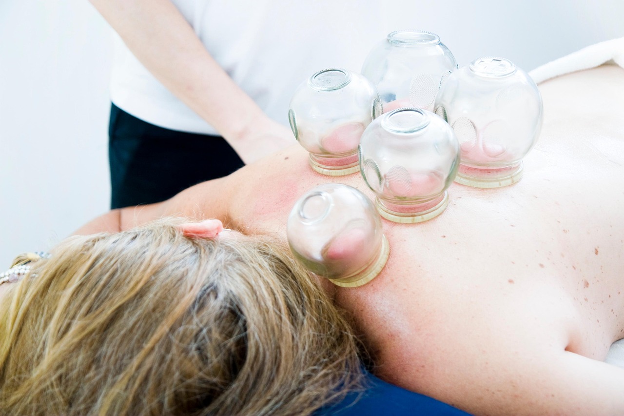 Alamo, CA - Where Can Athletes Find Cupping Services for Muscle Strain Recovery?
