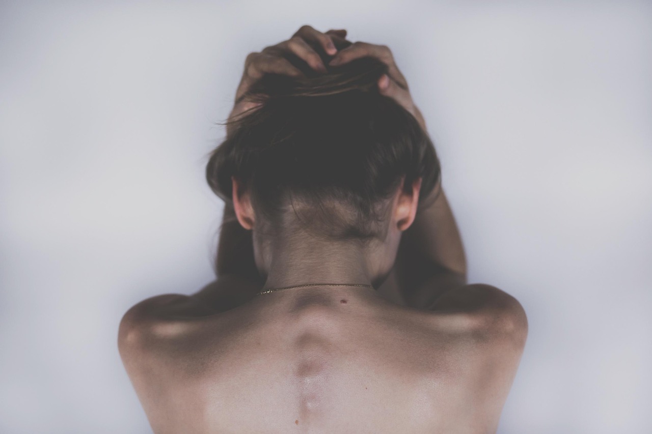 Lafayette, CA – Relieving Tension Headaches with Acupuncture and Cupping