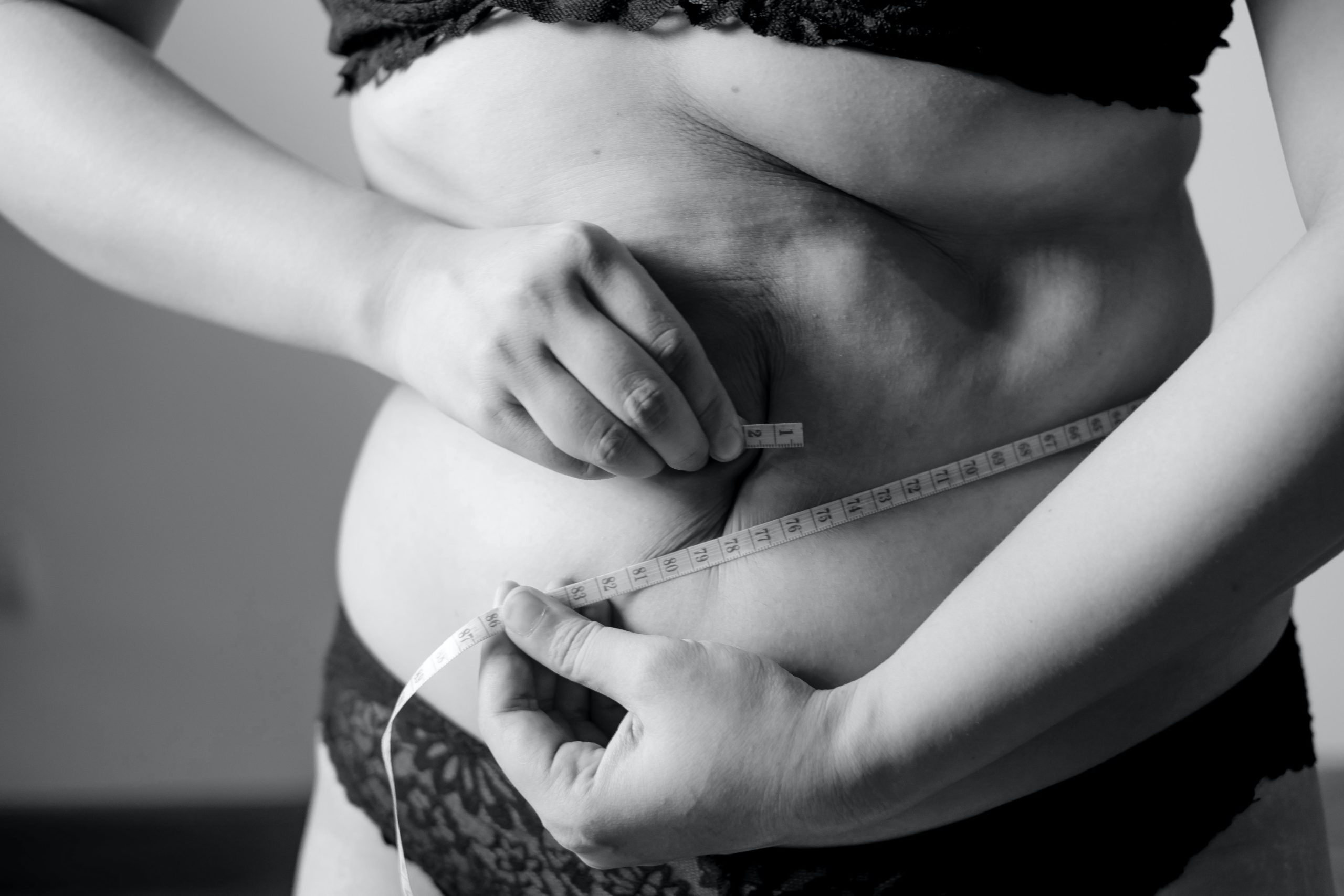 Oakland, CA - Supporting Healthy Weight Management with Acupuncture and Herbs