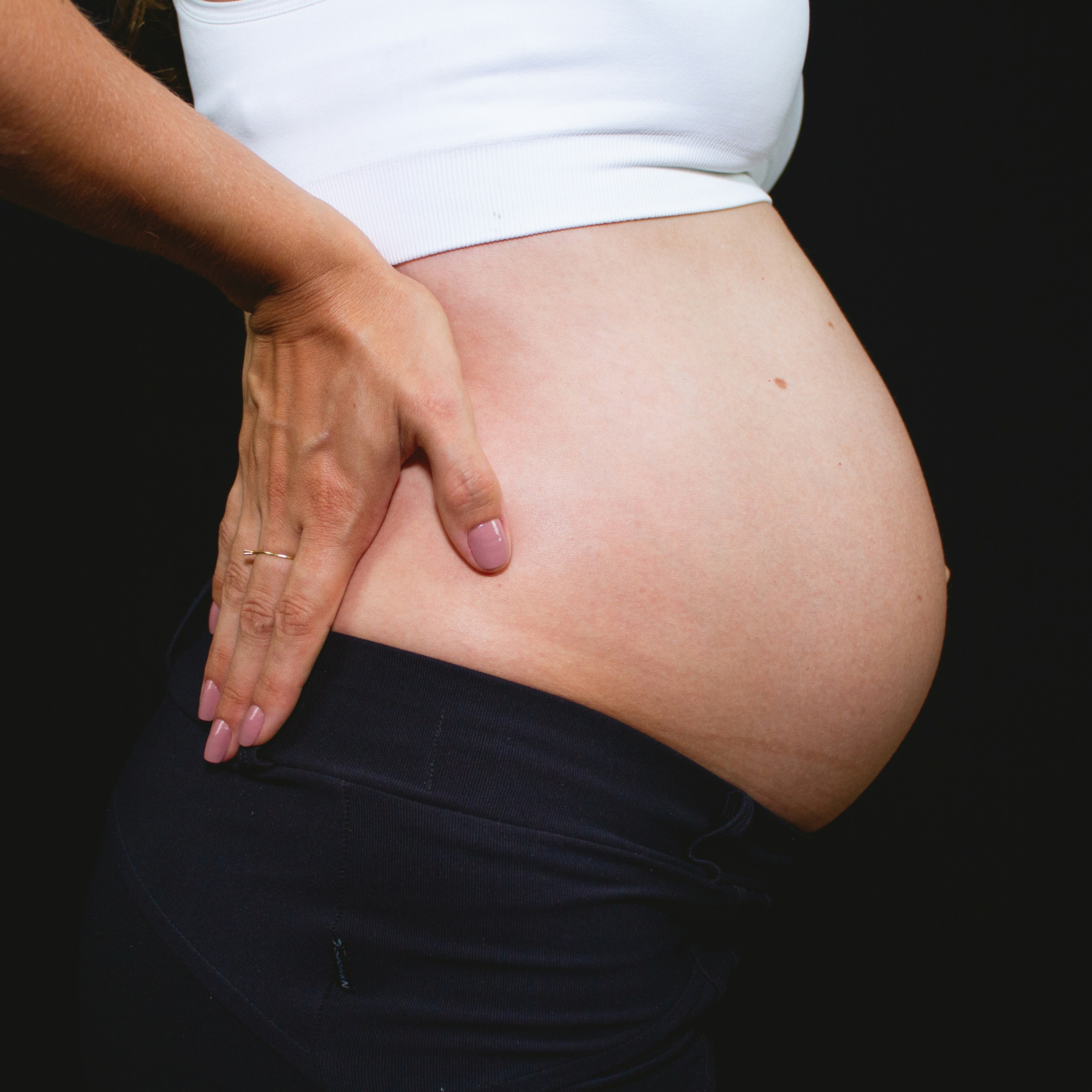 Lafayette, CA – Reduce Back Pain During Pregnancy with Acupuncture and Cupping