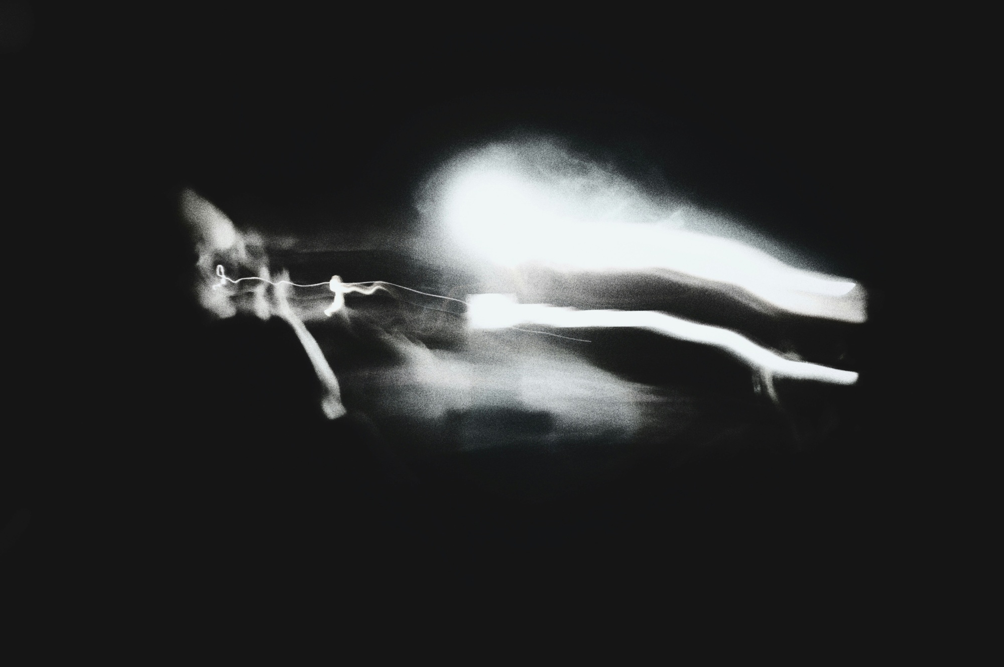 Picture Rocks, AZ - Why Are Orthopedic Treatments Important for Joint Health?