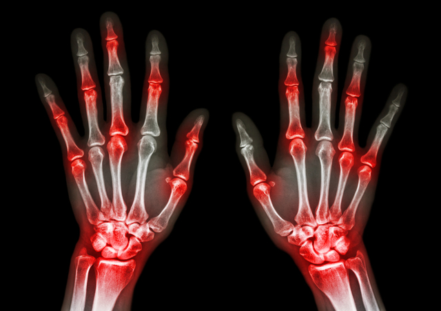 Paradise Valley, AZ - Non-Surgical Orthopedic Doctor Care for Arthritis Relief