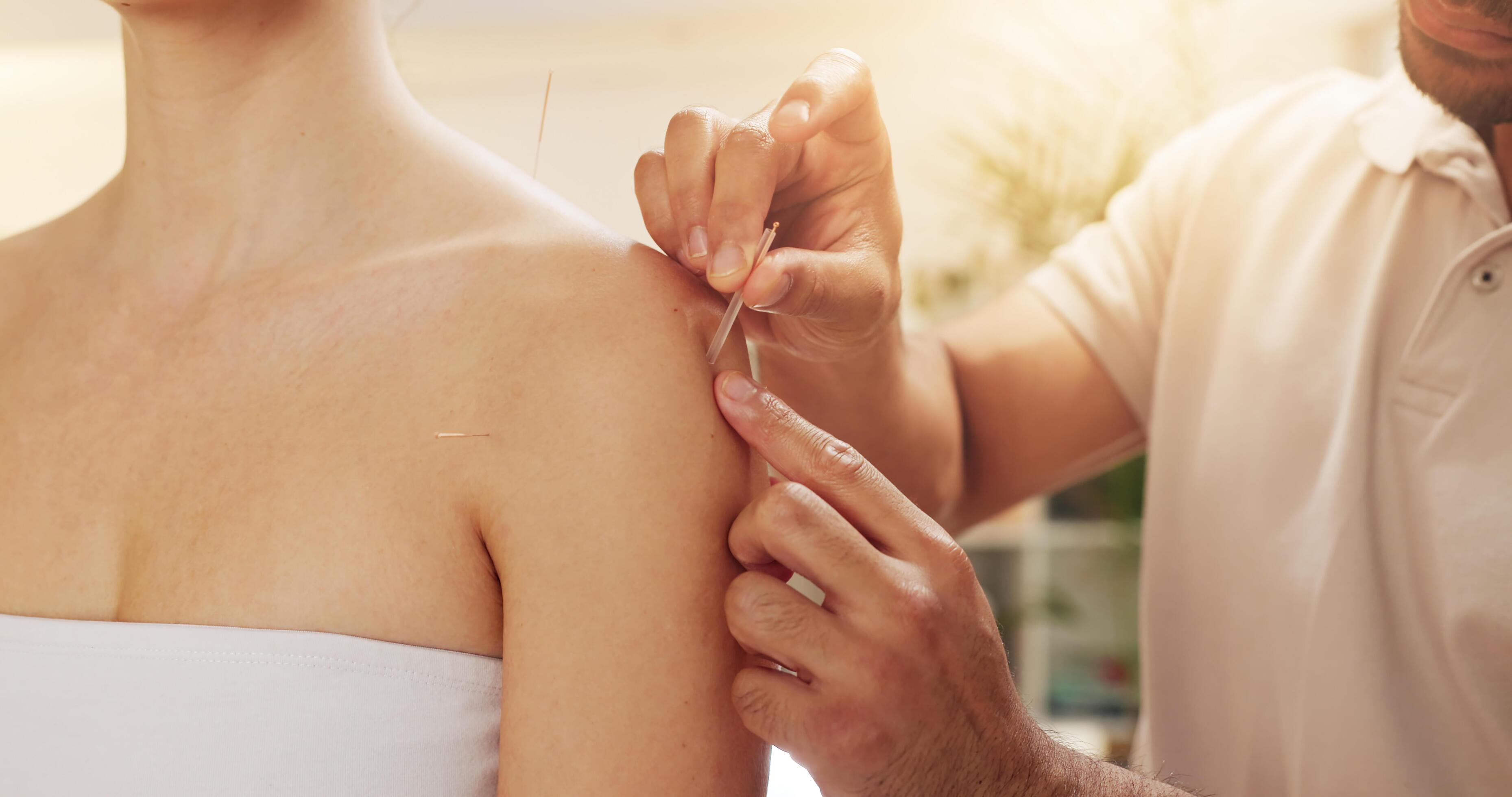 Tucson, AZ — Can Dry Needling Treatments Relieve Your Chronic Pain?