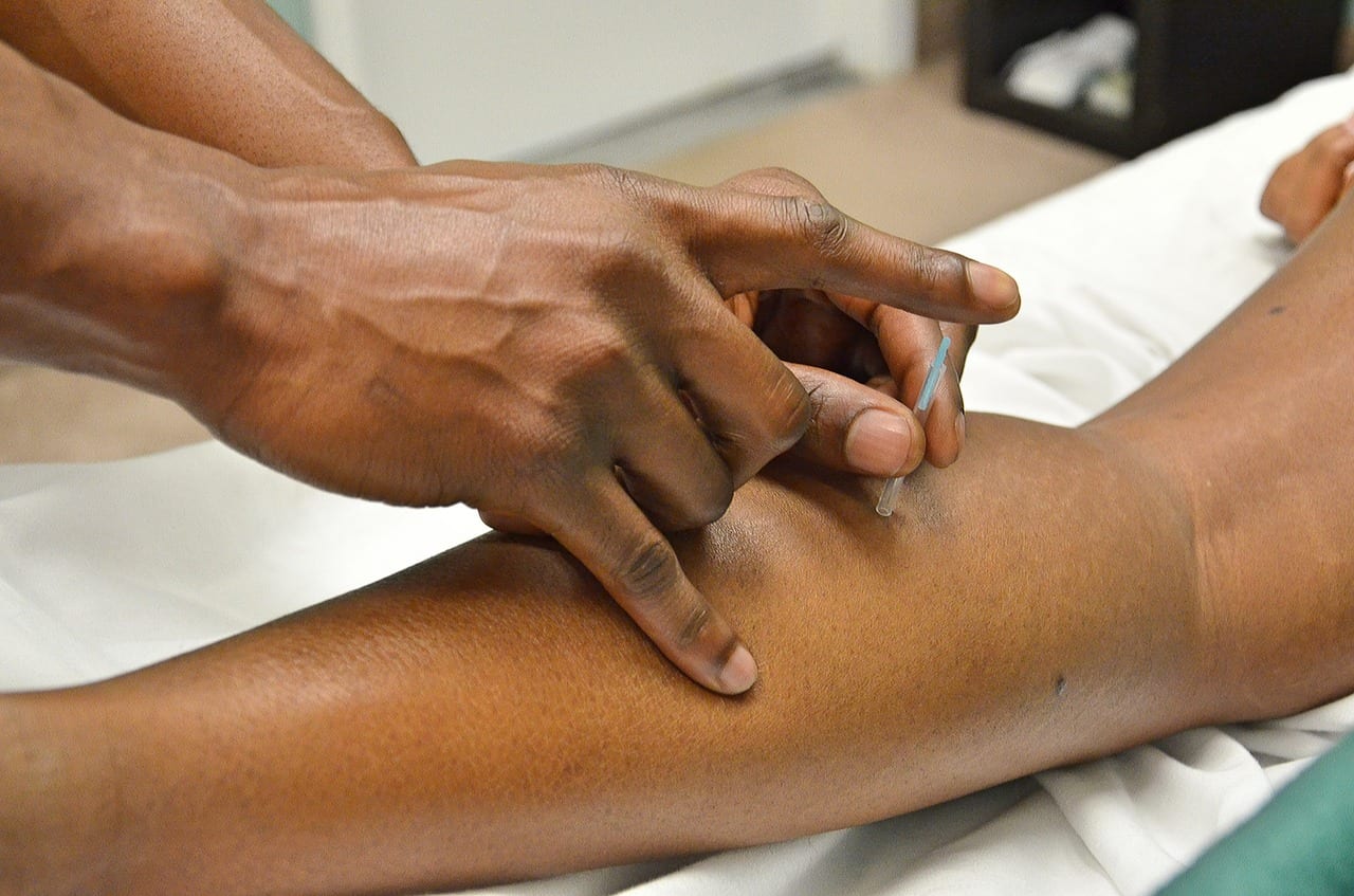 City, ST - Searching Local Top Rated Acupuncture Clinics or Acupuncturist?